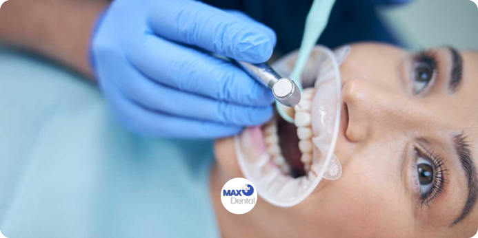 قیمت پر كردن دندان جلو دقیقاً چقدر است؟