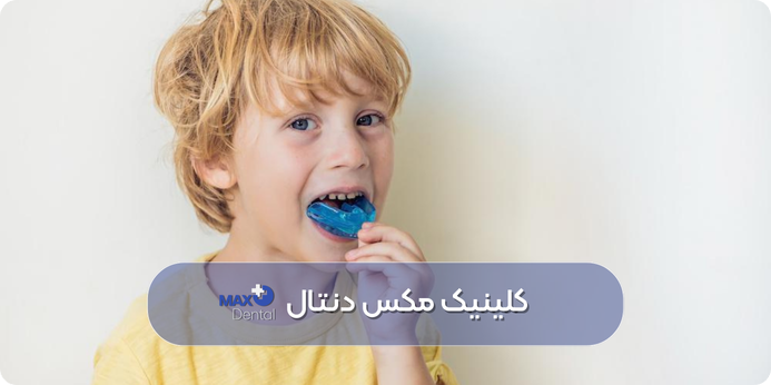  رویکردهای درمانی دندان قروچه در کودکان: پزشکی و خانگی
