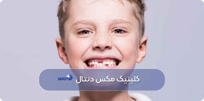 راهکارهای پیشگیری از دندان قروچه در کودکان