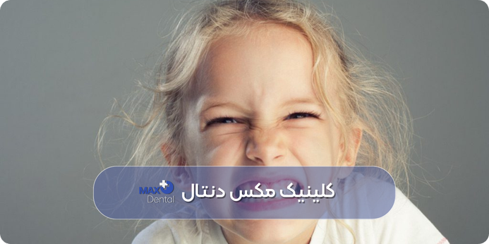 مشکلات رشد و تراز دندان‌ها؛ از دلایل و علت دندان قروچه کودکان در خواب 