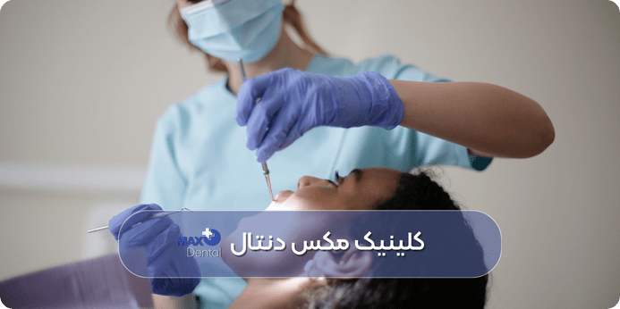 مراحل و مدت زمان در ترمیم دندان شکسته چقدر است