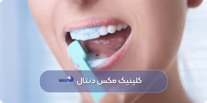 چگونه از شکستن مجدد دندان جلوگیری کنیم؟ پیشگیری از شکستگی دندان