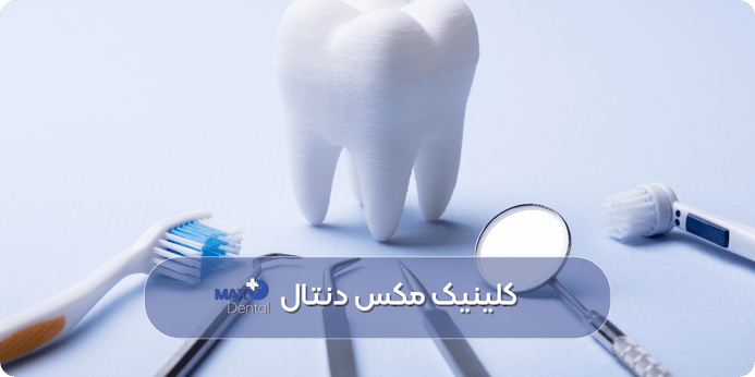 هزینه درمان شکستگی دندان تا چه میزان است؟