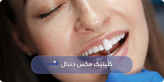 کاندیدای مناسب و موارد منع انجام کامپوزیت دندان