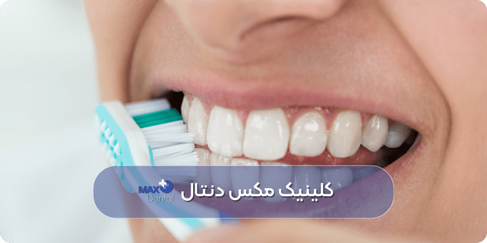راهکارهای پیشگیری از زرد شدن دندان‌ ها