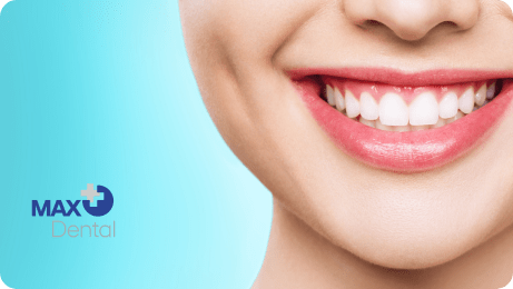 روش های سفید شدن دندانهای زرد در یک روز با راهکارهای فوری و بی خطر