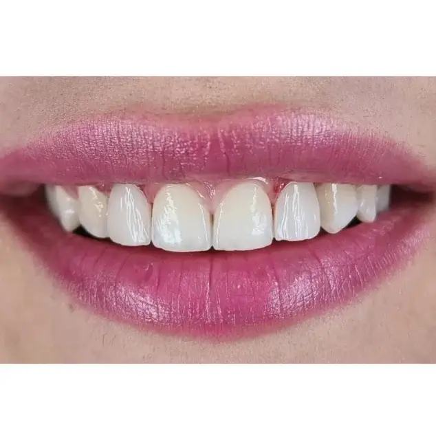 نمونه عکس لمینت