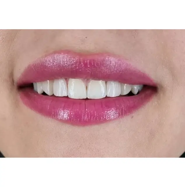 نمونه عکس لمینت
