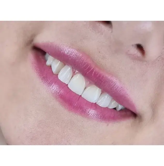 نمونه عکس لمینت
