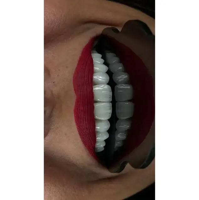 نمونه عکس لمینت