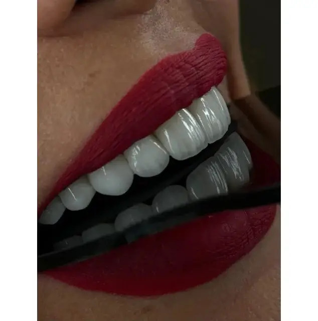 نمونه عکس لمینت