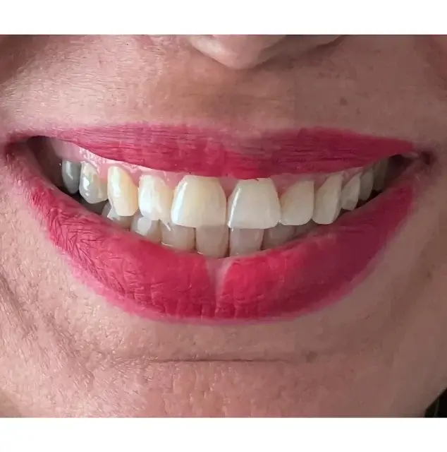 نمونه عکس لمینت