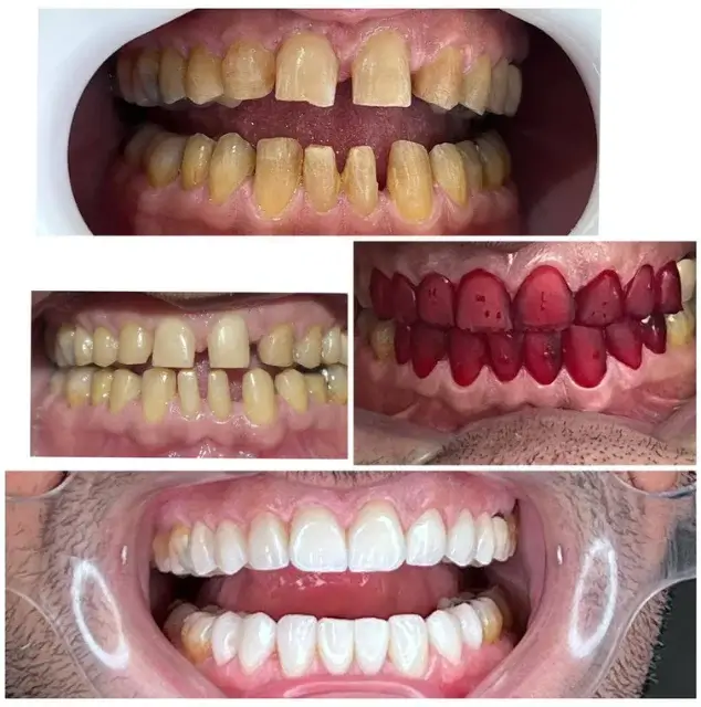 نمونه عکس لمینت