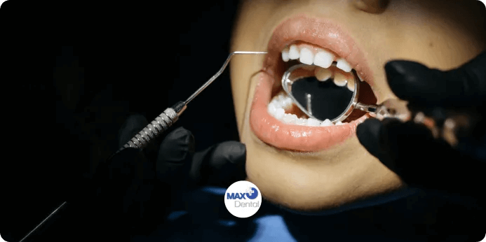 Cost of Dental Treatments in Tehran