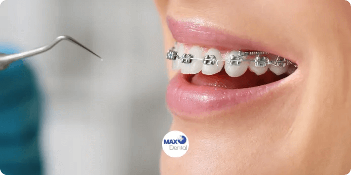 How to Find a Pediatric Dentist in Tehran Who Is the Best Fit for Your Family