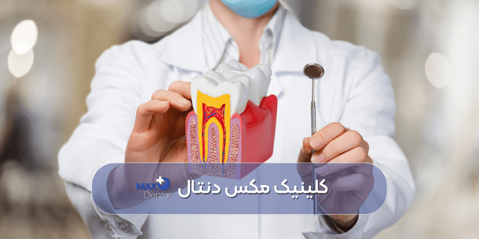 فیلم ترمیم دندان با عصب کشی یا درمان ریشه