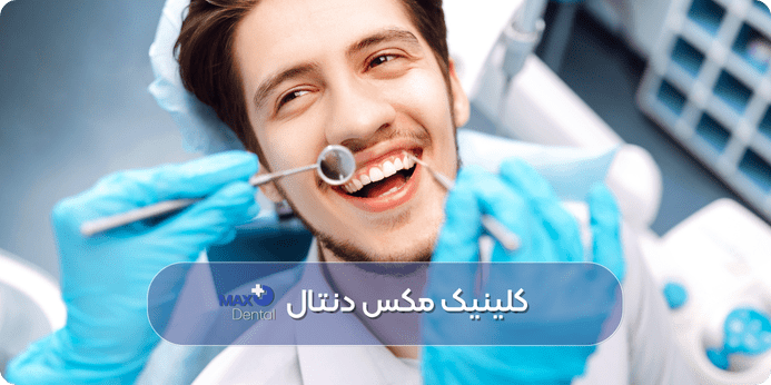 فیلم جرمگیری دندان