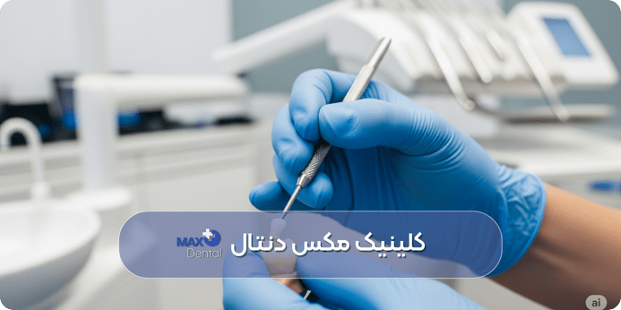 مدت زمان پر كردن دندان