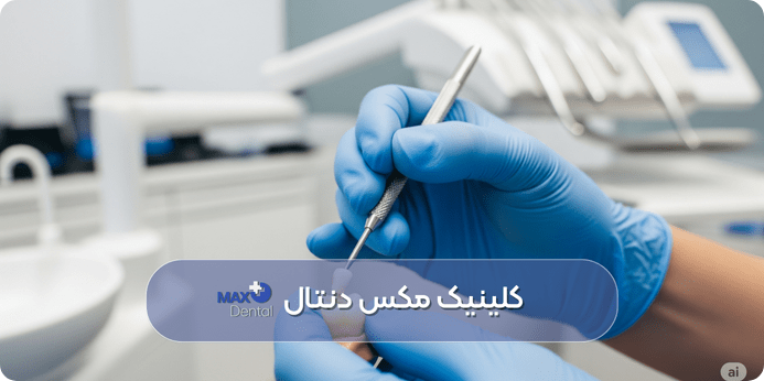 مدت زمان پر كردن دندان