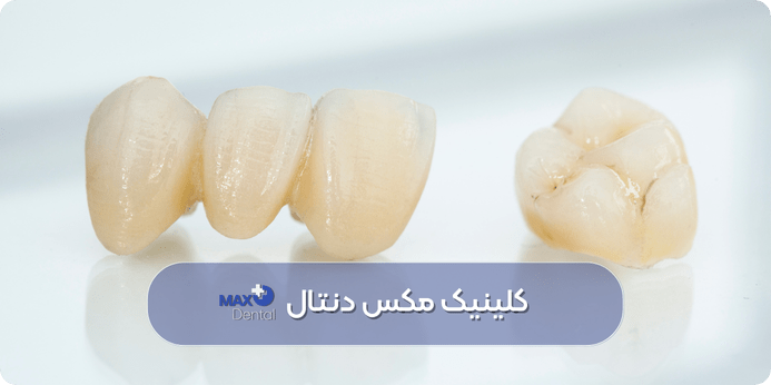 آسیب های غیرقابل بازگشت