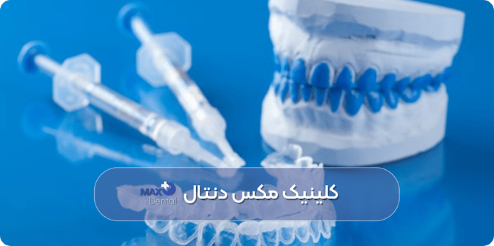 چه کسانی کاندید مناسب بلیچینگ هستند (و چه کسانی نیستند)