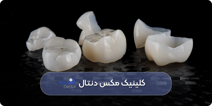 تفاوت ترمیم های موقتی و دائمی