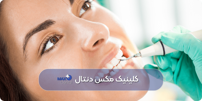 آیا جرمگیری دندان ضرر دارد