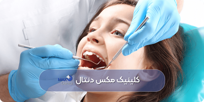 آیا جرمگیری دندان درد دارد