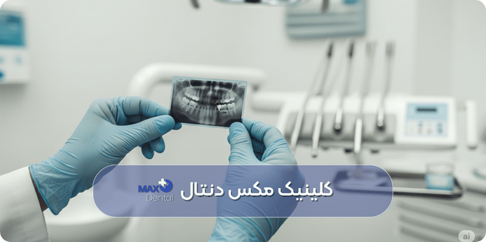 چه زمانی نیاز به تعویض مواد پر کننده دندان است