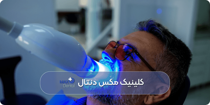آیا بلیچینگ دنداد درد دارد