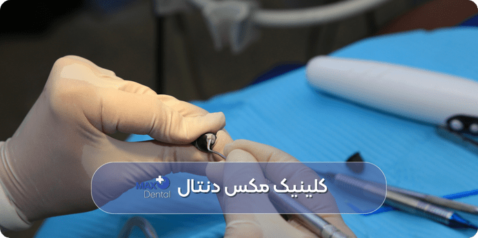 هزینه ترمیم دندان چقدر است و چه عواملی روی آن تأثیر دارد