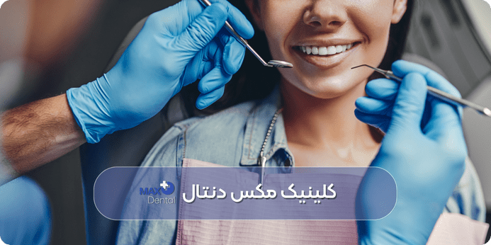 جرم گیری دندان به چه صورت است