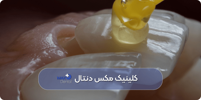  کاندیدای ایده آل و موارد منع مصرف