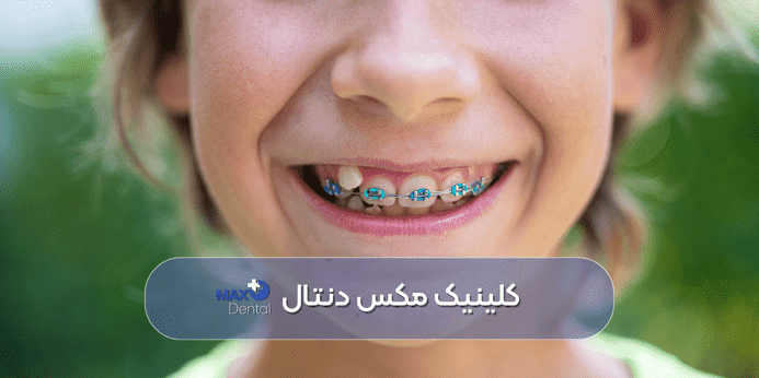 آیا سن ارتودنسی دندان هر چقدر کمتر باشد، بهتر است