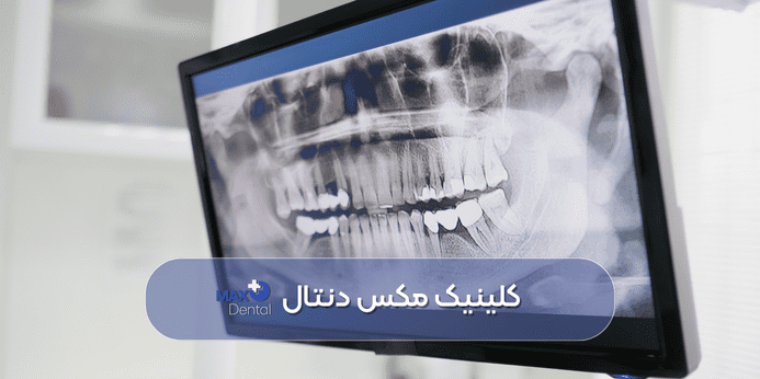 چرا هفت سالگی بهترین سن ارتودنسی دندان برای معاینه اولیه می باشد