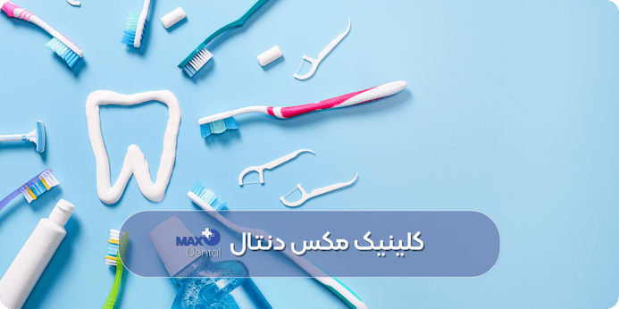 مراقبت های انواع جایگزین دندان کشیده شده